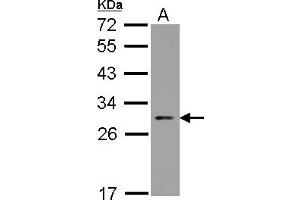 Western Blotting (WB) image for anti-Nucleolar Protein 3 (Apoptosis Repressor with CARD Domain) (NOL3) (AA 1-197) antibody (ABIN1501899) (NOL3 anticorps  (AA 1-197))