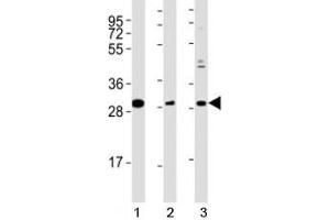 Western blot testing of Nkx2.