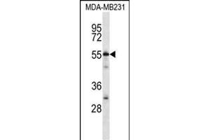 CABIN486182 and ABIN1535563 Antibody (N-term) (ABIN657088 and ABIN2837891) western blot analysis in MDA-M cell line lysates (35 μg/lane). (C7ORF25 anticorps  (N-Term))