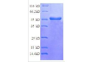 NADH Dehydrogenase (Ubiquinone) Flavoprotein 2, 24kDa (NDUFV2) (AA 35-249), (partial) protein (GST tag)