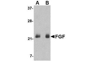 Western blot analysis of FGF4 in NIH 3T3 cell lysate with AP30336PU-N FGF4 antibody at (A) 0. (FGF4 anticorps  (C-Term))