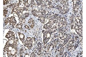 IHC analysis of DBC-1/CCAR2 using anti-DBC-1/CCAR2 antibody (ABIN7602235). (CCAR2 anticorps  (AA 65-917))