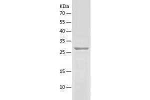 LY6E Protein (AA 21-101) (His-IF2DI Tag)