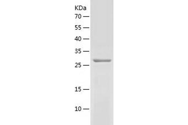 LY6E Protein (AA 21-101) (His-IF2DI Tag)