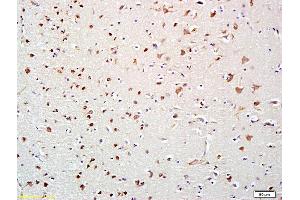 Formalin-fixed and paraffin embedded human brain labeled with Anti-HDAC10 Polyclonal Antibody, Unconjugated (ABIN681298) at 1:200 followed by conjugation to the secondary antibody and DAB staining (HDAC10 anticorps  (AA 561-669))