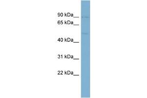WB Suggested Anti-EGR1 Antibody Titration: 0. (EGR1 anticorps  (Middle Region))
