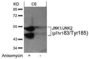 Image no. 2 for anti-Mitogen-Activated Protein Kinase 8 (MAPK8) (pThr183), (pTyr185) antibody (ABIN401563) (JNK anticorps  (pThr183, pTyr185))