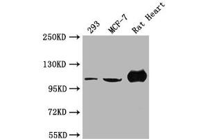 Western Blot Positive WB detected in: 293 whole cell lysate, MCF-7 whole cell lysate, Rat Heart tissue All lanes: ACTN2 antibody at 1:2000 Secondary Goat polyclonal to rabbit IgG at 1/50000 dilution Predicted band size: 104 kDa Observed band size: 104 kDa (ACTN2 anticorps  (AA 1-301))