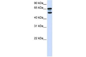 Western Blotting (WB) image for anti-F-Box Protein 21 (FBXO21) antibody (ABIN2458715)