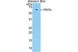 Detection of Recombinant TNNC2, Human using Polyclonal Antibody to Troponin C Type 2, Fast (TNNC2)