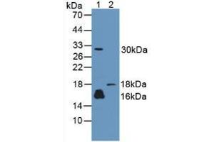 Western blot analysis of (1) Human A431 Cells and (2) Rat Skin Tissue. (CALML3 anticorps  (AA 1-149))