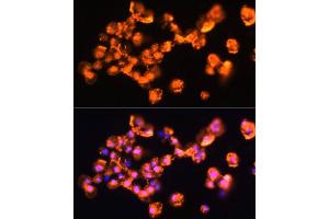 Immunofluorescence analysis of  cells using PRKCB antibody (ABIN6128463, ABIN6146200, ABIN6146202 and ABIN6221544) at dilution of 1:100. (PKC beta anticorps  (AA 220-340))