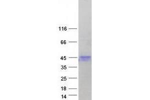 Validation with Western Blot
