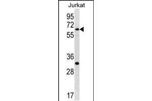 Western blot analysis in Jurkat cell line lysates (35ug/lane). (SMARCD1 anticorps  (C-Term))