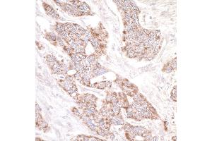 anti-Rap Guanine Nucleotide Exchange Factor (GEF) 2 (RAPGEF2) (AA 975-1025) antibody
