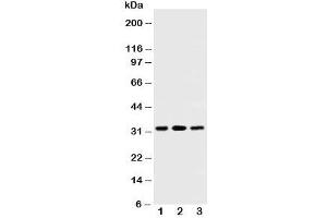 Western blot testing of SDHB antibody and Lane 1:  rat testis;  2: rat heart;  3: Jurkat cell lysate. (SDHB anticorps  (AA 42-59))