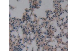 IHC-P analysis of lung tissue, with DAB staining. (DOK3 anticorps  (AA 160-409))