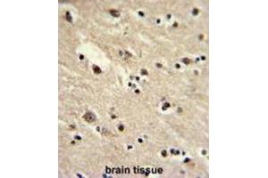 Immunohistochemistry (IHC) image for anti-Eukaryotic Translation Elongation Factor 1 alpha 1 (EEF1A1) antibody (ABIN3002704)