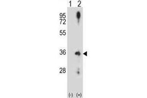 Western blot analysis of Cyclin D2 antibody and 293 cell lysate (2 ug/lane) either nontransfected (Lane 1) or transiently transfected (2) with the CCND2 gene.