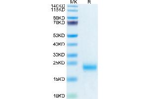 Human/Cynomolgus/Rhesus macaque ROR1 (165-305, Frizzled Domain) on Tris-Bis PAGE under reduced condition.