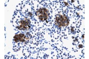 ZNF21 antibody was used for immunohistochemistry at a concentration of 4-8 ug/ml to stain Epithelial cells of pancreatic acinus (lndicated with Arrows) in Human Pancreas. (ZNF182 anticorps  (Middle Region))