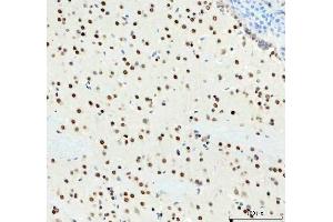 IHC analysis of DDX1 using anti-DDX1 antibody (ABIN7602052).
