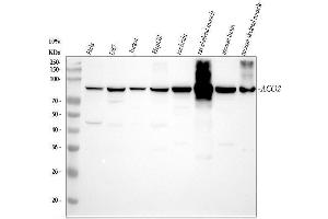 Western blot analysis of ACO2 using anti-ACO2 antibody (ABIN4886417).