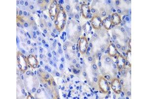 Immunohistochemistry of paraffin-embedded Mouse kidney using MATK Polyclonal Antibody at dilution of 1:100 (40x lens). (MATK anticorps)