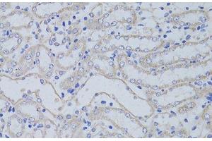 Immunohistochemistry of paraffin-embedded Mouse kidney using AQP5 Polyclonal Antibody at dilution of 1:50 (40x lens). (Aquaporin 5 anticorps)