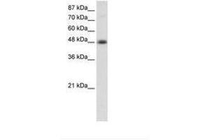 Image no. 1 for anti-Transcription Factor AP-2 beta (Activating Enhancer Binding Protein 2 Beta) (TFAP2B) (AA 372-421) antibody (ABIN202550) (TFAP2B anticorps  (AA 372-421))