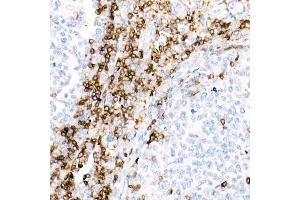 Immunohistochemistry of paraffin-embedded Human tonsil using CD7 antibody (ABIN7266214) at dilution of 1:10000 (40x lens). (CD7 anticorps)