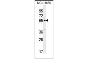 Western blot analysis of SHISA6 Antibody (N-term) in NCI-H460 cell line lysates (35ug/lane). (SHISA6 anticorps  (N-Term))