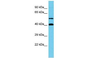 anti-Chromosome 17 Open Reading Frame 85 (C17ORF85) (C-Term) antibody