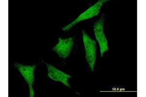 Immunofluorescence of purified MaxPab antibody to RIOK2 on HeLa cell. (RIOK2 anticorps  (AA 1-552))