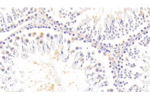 Detection of SIRT4 in Rat Testis Tissue using Polyclonal Antibody to Sirtuin 4 (SIRT4)
