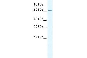 WB Suggested Anti-TGFB1I1 Antibody Titration: 0. (TGFB1I1 anticorps  (Middle Region))