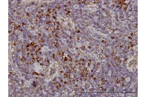 Immunoperoxidase of monoclonal antibody to KIFC1 on formalin-fixed paraffin-embedded human lymph node. (KIFC1 anticorps  (AA 53-152))