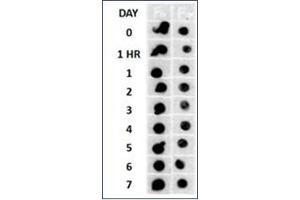 Beta Amyloid HEPES-NaCl aggregation, showing 1/500 (Left) and 1/5000 (Right) time lapse dot blot. (Amyloid Fibrils anticorps)