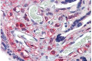 Placenta, Human: Formalin-Fixed, Paraffin-Embedded (FFPE)