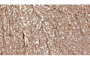 Detection of GFAP in Rat Spinal cord Tissue using Polyclonal Antibody to Glial Fibrillary Acidic Protein (GFAP) (GFAP anticorps  (AA 1-430))
