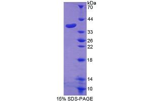 SDS-PAGE analysis of Human GLVR1 Protein. (SLC20A1 Protéine)