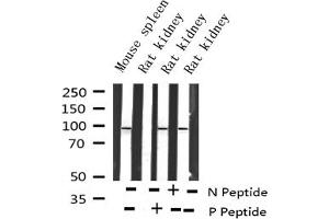Western blot analysis of Phospho-FKHRL1 (Ser253) expression in various lysates