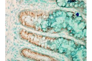 Immunohistochemistry analysis using Rabbit Anti-TLR4 Polyclonal Antibody (ABIN361724).