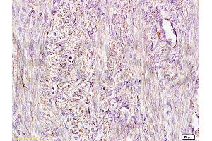 Immunohistochemistry (IHC) image for anti-alpha-Fetoprotein (AFP) antibody (ABIN722916) (alpha Fetoprotein anticorps)
