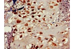 Immunohistochemistry of paraffin-embedded human placenta tissue using ABIN7158837 at dilution of 1:100 (LOXL2 anticorps  (AA 27-121))
