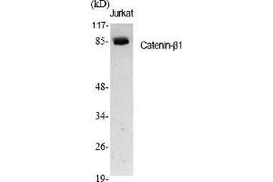 Western Blot analysis of various cells using Catenin-β1 Polyclonal Antibody diluted at 1:1000.