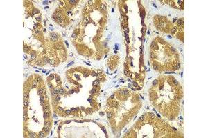 Immunohistochemistry of paraffin-embedded Human kidney using RAB1B Polyclonal Antibody at dilution of 1:100 (40x lens). (RAB1B anticorps)