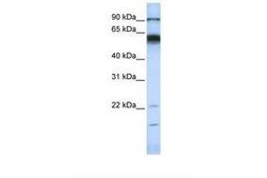 Image no. 1 for anti-Matrix Metallopeptidase 16 (Membrane-inserted) (MMP16) (AA 72-121) antibody (ABIN6738261)