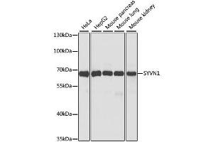 Western blot analysis of extracts of various cell lines, using SYVN1 antibody. (SYVN1 anticorps  (C-Term))