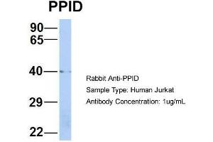 Host: Rabbit  Target Name: PPID  Sample Tissue: Human Jurkat  Antibody Dilution: 1. (PPID anticorps  (Middle Region))
